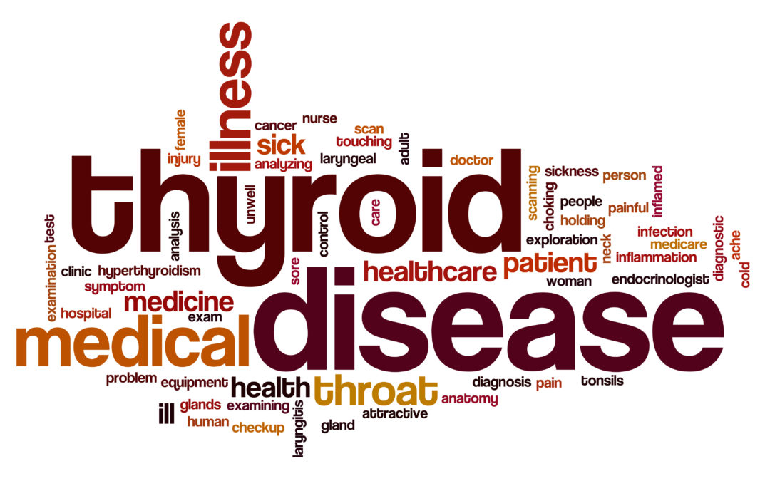 What You Need to know about Subclinical hypothyroidism and PCOS